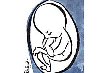 Supreme Court denies permission to woman to terminate 27-week foetus 